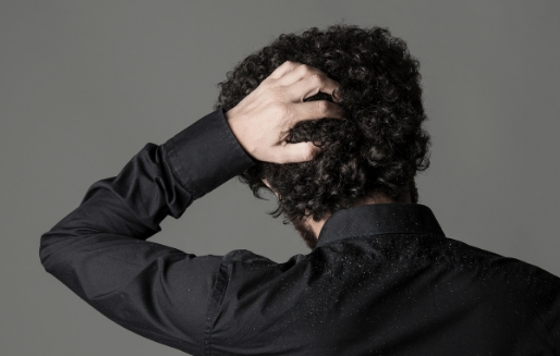 Πιτυρίδα: Γιατί εμφανίζεται & πώς καταπολεμάται;